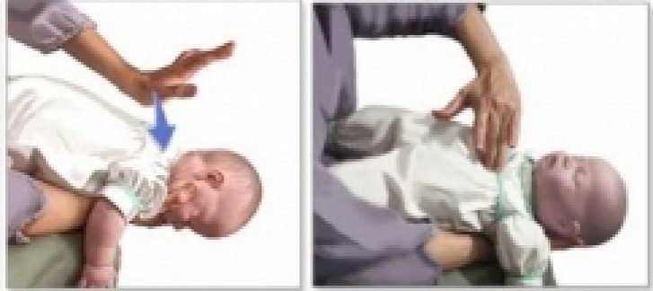 Policiais salvam bebê de 21 dias com manobra de heimlich