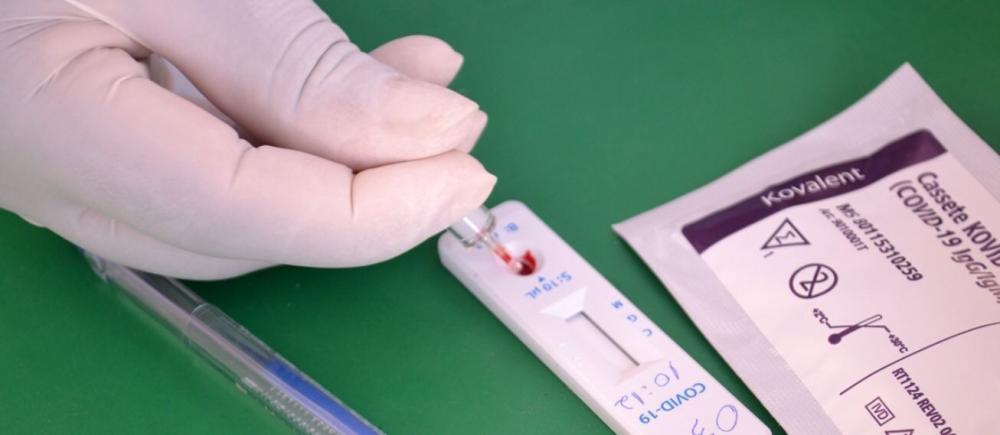 Feira tem redução de 77% dos casos da Covid-19