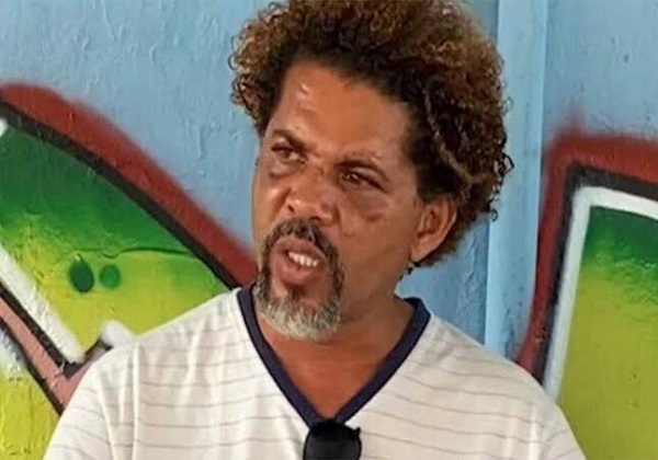 Mulher que teve relações sexuais com mendigo é diagnosticada com transtorno bipolar