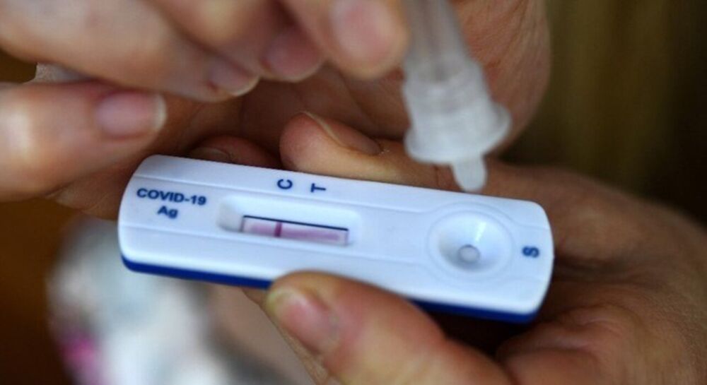 Vendas de autoteste de Covid aumentam mais de 1.500% em farmácias
