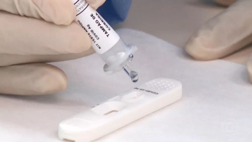 Bahia registra 3.165 casos de Covid-19 em 24h e 15 óbitos pela doença; Salvador tem 82% de ocupação da UTI adulto