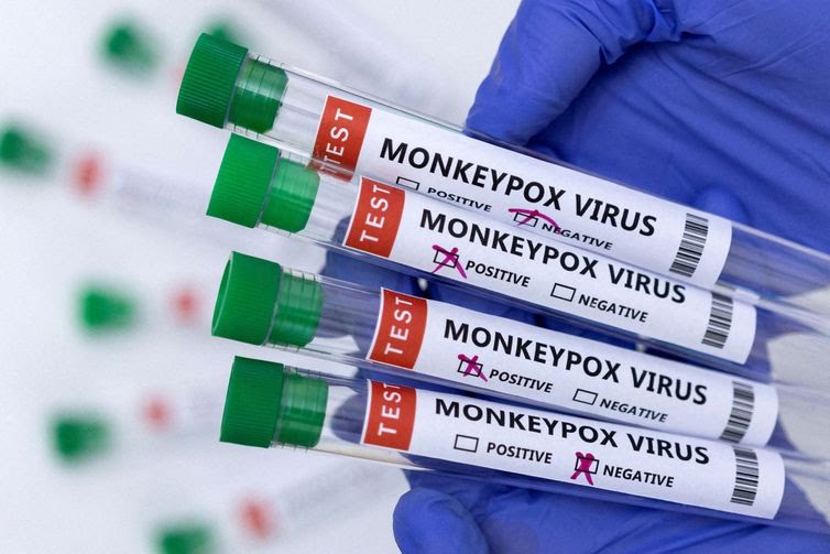 Bahia confirma mais dois casos de Monkeypox