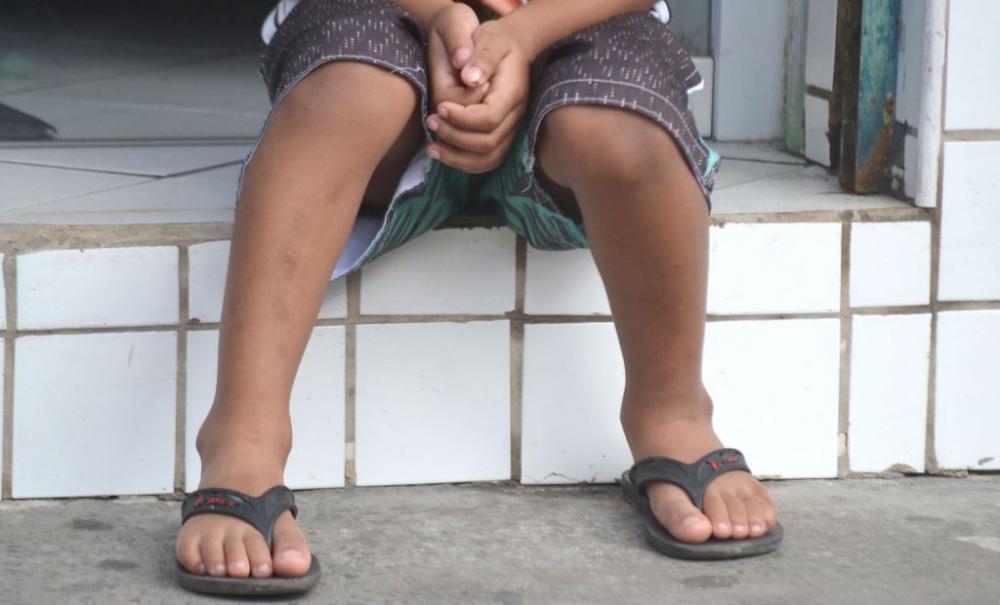 Varíola dos macacos atinge até crianças