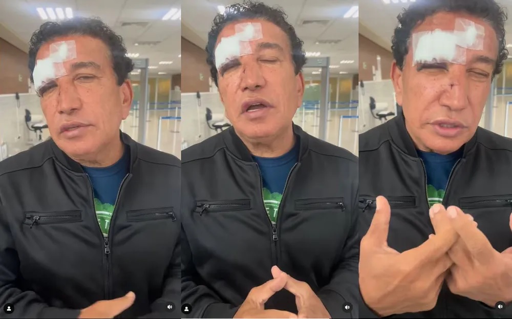 Magno Malta é hospitalizado com ferimentos no rosto após vidro de banheiro de hotel quebrar na Bahia