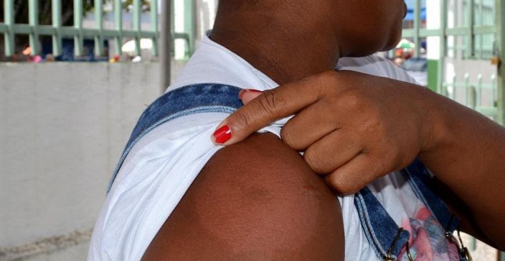 Cidade tem redução de 7% nos casos de hanseníase