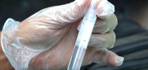 Vacina do Butantan para dengue em parceria com a Fiocruz Bahia protege 79,6%