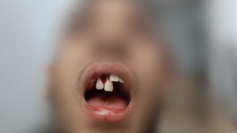 Advogado é preso acusado de quebrar dentes de entregador, mas paga fiança de R$ 100 mil e é solto