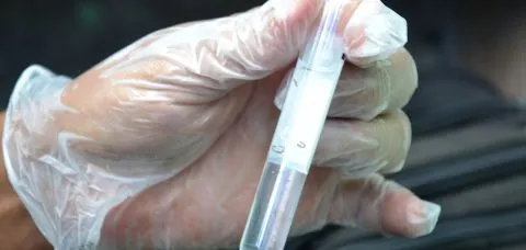 Dengue segue matando na Bahia; são 86 óbitos este ano