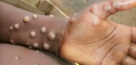 Foto: Divulgação/Internet