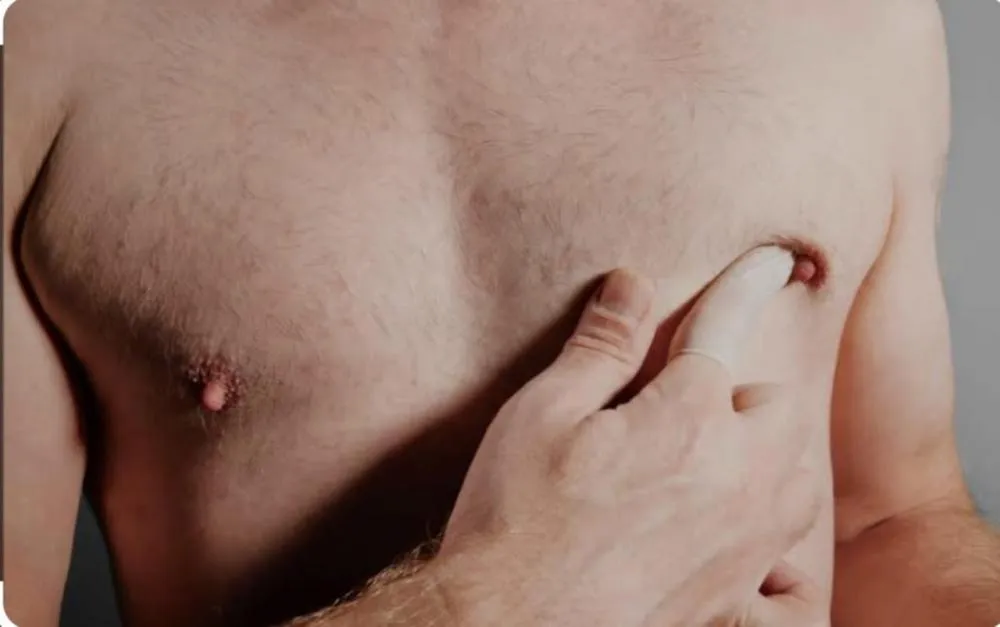 Outubro Rosa: urologista alerta para os riscos do câncer de mama em homens e a importância da prevenção