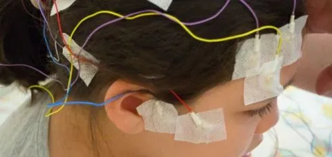 AVC é a causa da morte de seis brasileiros por hora