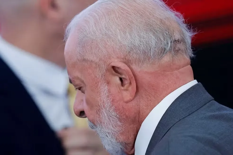 Lula passa por procedimento para evitar novo sangramento na cabeça e já está acordado, diz médico