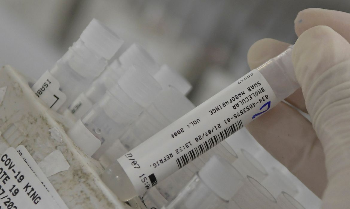 Brasil atualiza dados da pandemia com 3,5 mi de casos, sendo 2,6 mi de recuperados