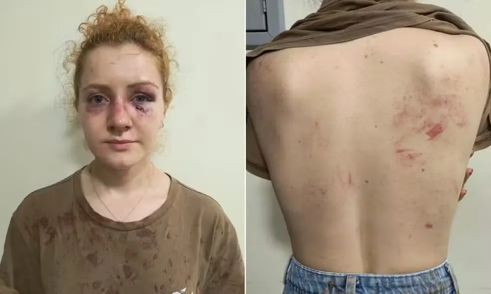 Polícia investiga homem, namorada e sogra por agressão contra jovem na Bahia; vítima era amiga do suspeito