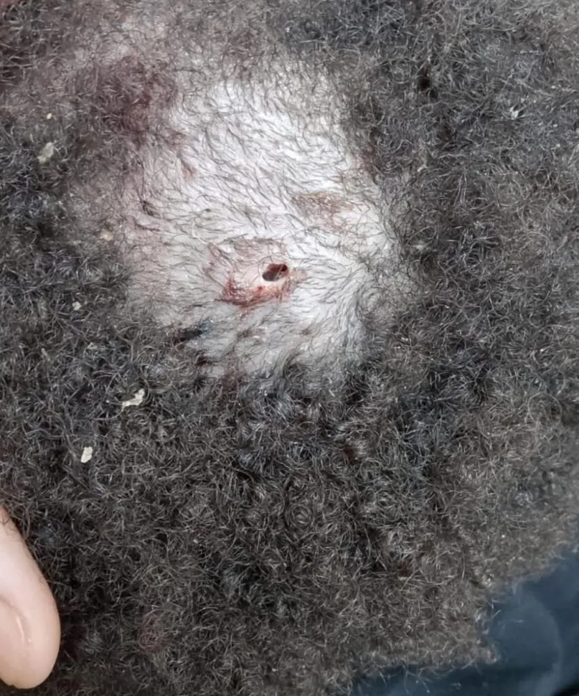 Mãe faz apelo por urgência em procedimento para filha de 3 anos internada com buraco e larvas na cabeça no Hospital da Criança