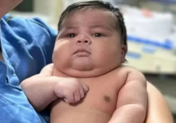 Bebê ‘gigante’ nasce com mais de 6 kg em parto arriscado