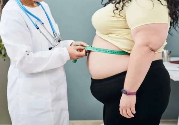 Dia de Prevenção da Obesidade: saiba como manter peso saudável e evitar doenças