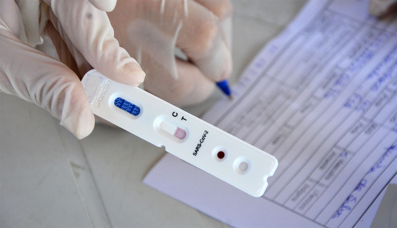 Feira de Santana tem menos de 10% de casos ativos de Covid-19 e mantém curva de redução da doença