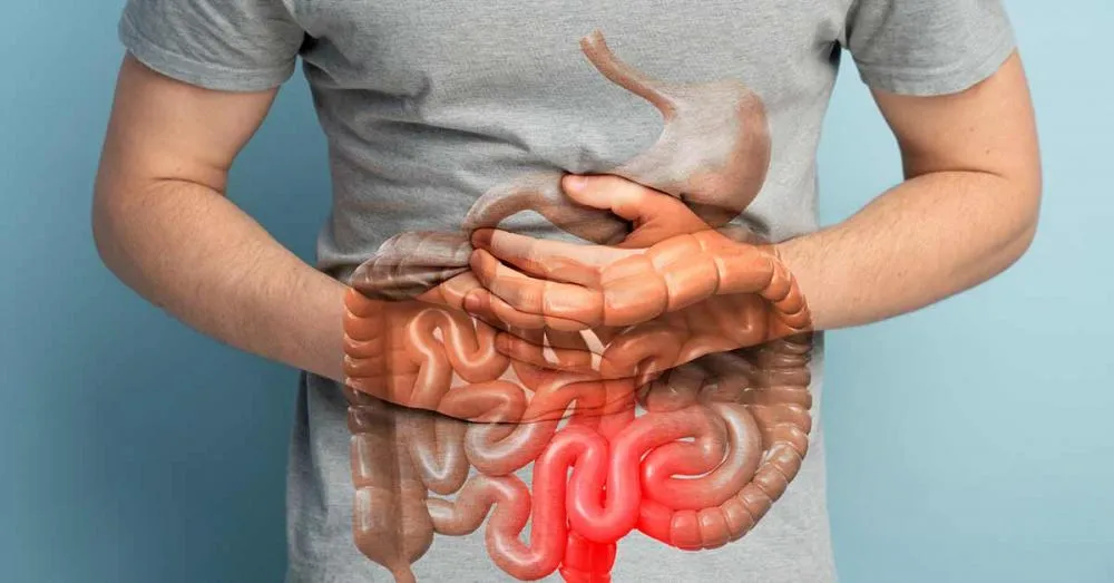 Foto: Reprodução / Internet 