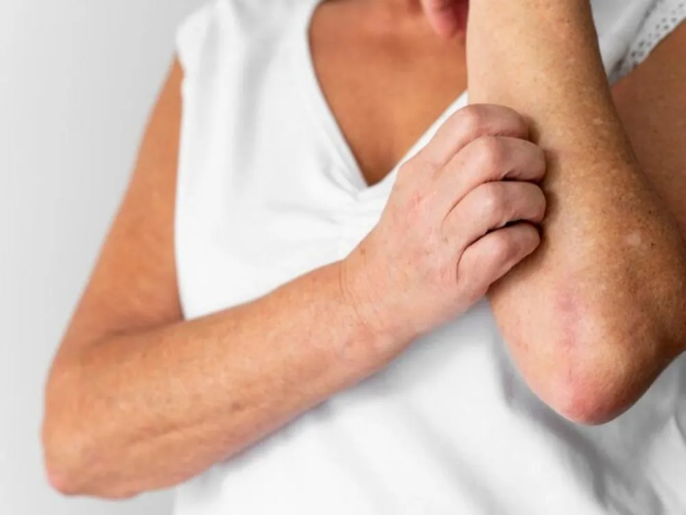 Foto: Reprodução / Internet 