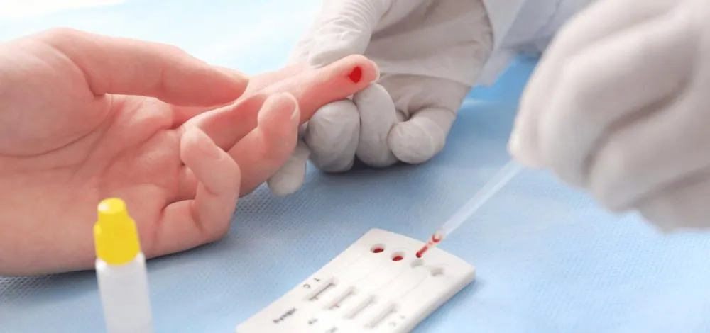 Fiocruz lança estudo inédito para ampliar prevenção ao HIV entre jovens