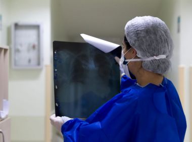 Número de casos ativos do Coronavírus está em redução na Bahia, aponta SESAB