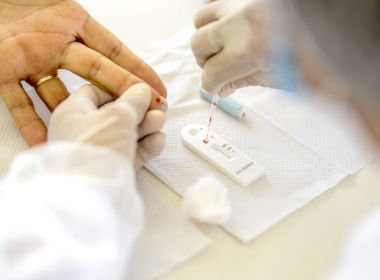 Estados Unidos têm primeiro caso confirmado de reinfecção de Covid-19