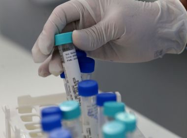 Casos ativos de Covid-19 caem na Bahia