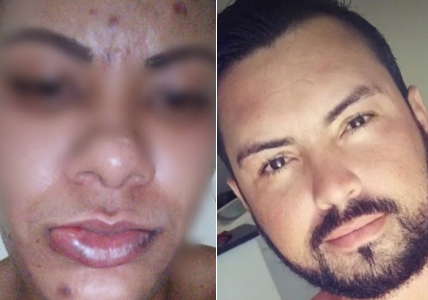 Agressor de Ilhéus: Em 6 meses de namoro, vítima apanhou mais de 5 vezes, relata mulher