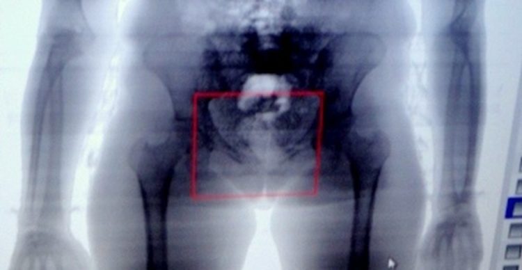 Cinco mulheres são flagradas quando tentavam entrar em presídio com drogas escondidas