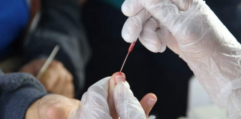 Bahia tem maior número de casos ativos da Covid-19 dos últimos 75 dias