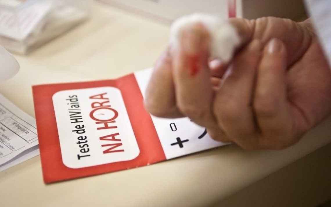 Governo deixa contrato vencer e suspende exames de HIV e hepatites virais no SUS