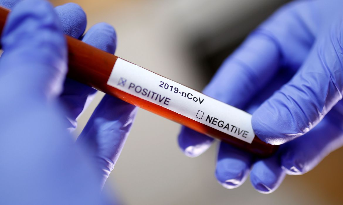 Covid-19: Brasil soma 6,72 milhões de casos desde o início da pandemia