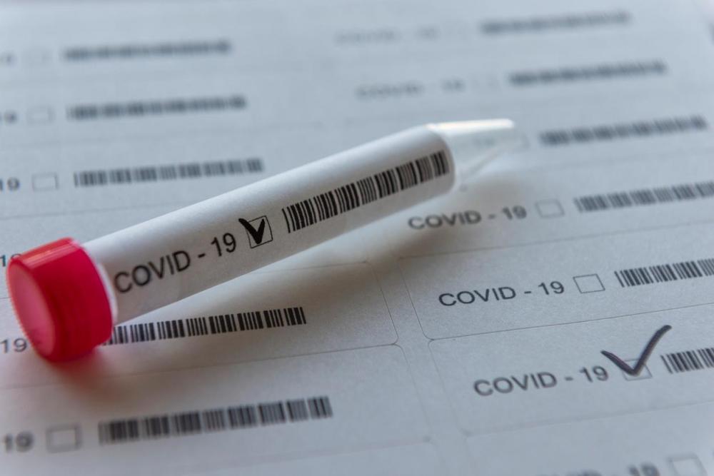 Feira de Santana não registra nenhuma morte por Covid-19 há dois dias