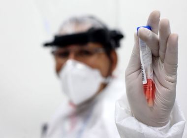 Com agravamento da pandemia na BA, ocupação de leitos de UTI vai a 76%