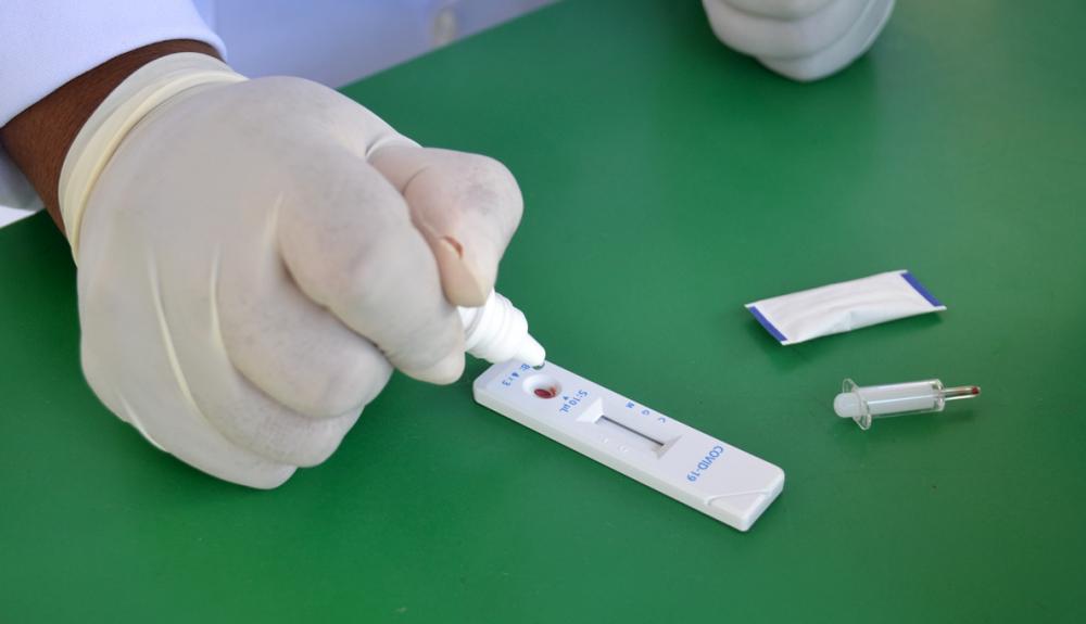 Prefeitura de Feira intensifica testagem contra a Covid-19 em Humildes