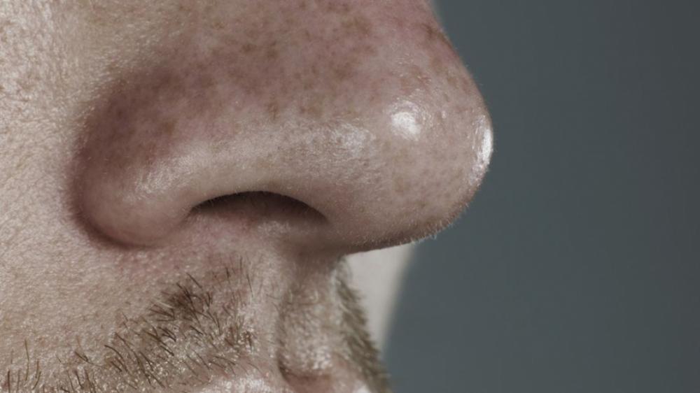 Sequelas da Covid-19 podem persistir por longo prazo até em casos como perda do olfato