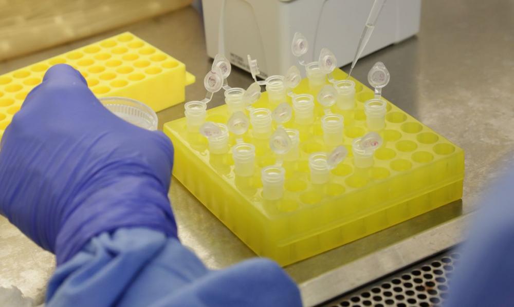 Testes para vacina contra HIV têm resultados promissores em laboratório