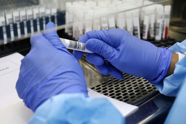 Covid-19: quase 500 pessoas aguardam resultados de exames em Feira de Santana