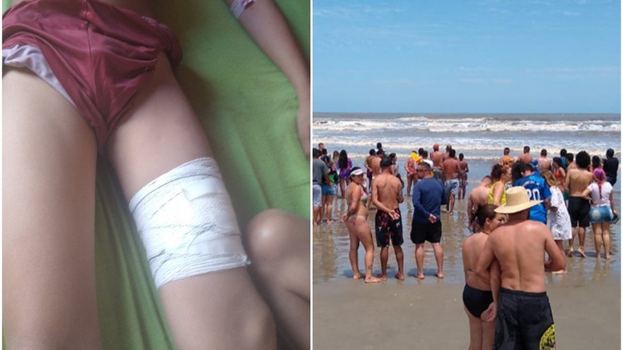 Menino de 11 anos é ferido por tubarão enquanto brincava no mar de praia de SP