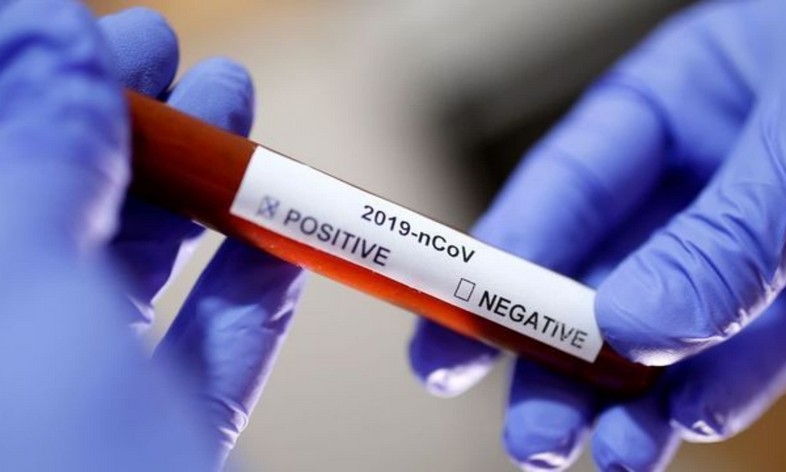 Bahia tem segundo dia consecutivo com mais de 3 mil casos ativos de Covid-19 após 3 meses