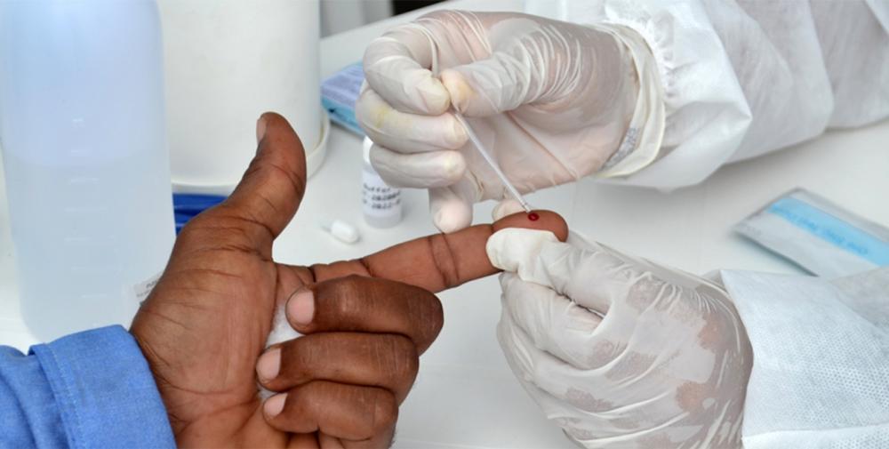 Governo diz estar atento ao aumento do número de casos de HIV em Feira