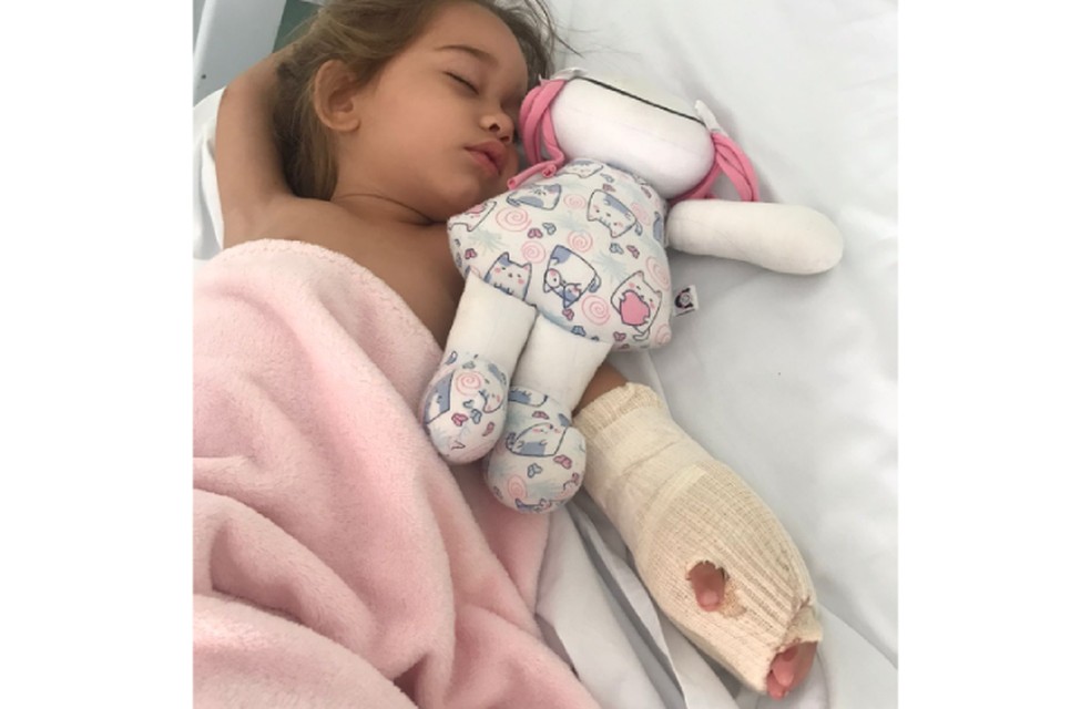 Criança que ficou com a mão presa em escada rolante de loja faz cirurgia para reconstrução dos dedos