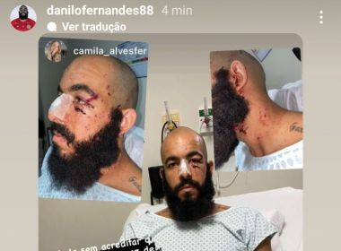 Internado, Danilo Fernandes expõe marcas do atentado com bomba: 